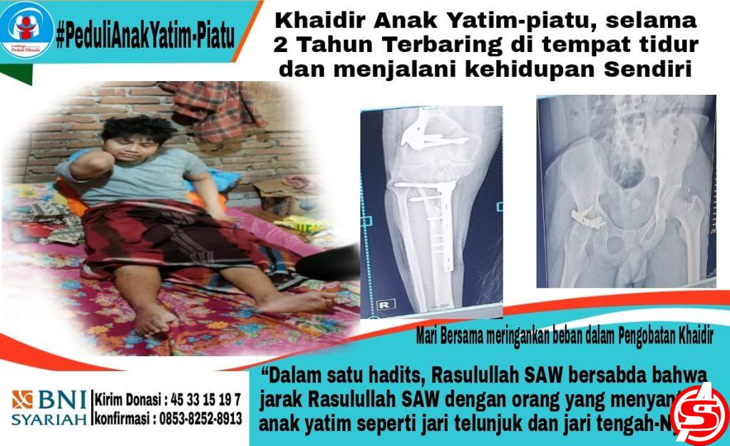 Anak Yatim-Piatu Ini Butuh Bantuan, 2 Tahun Terbaring di Tempat Tidur