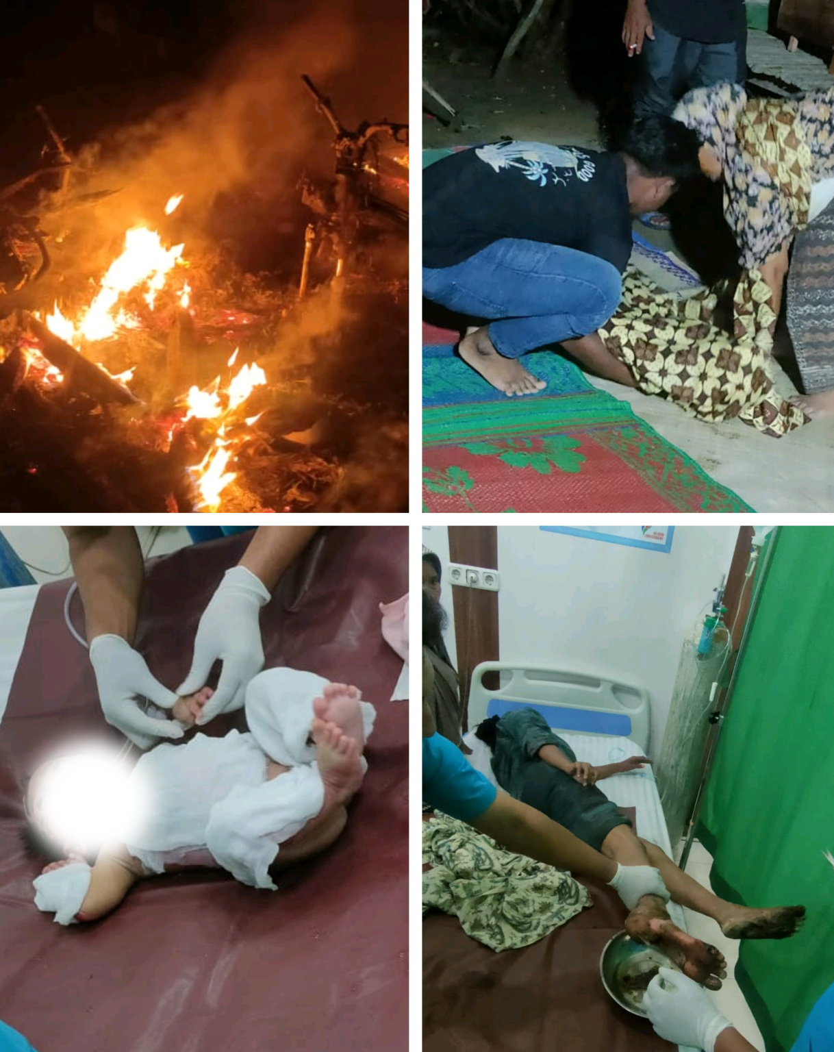 Rumah Ludes Terbakar, Satu Bayi Meninggal dan Dua Luka Bakar